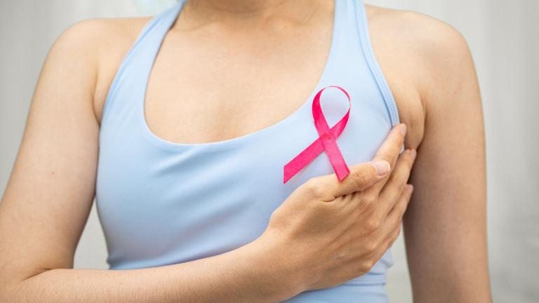 Breast cancer